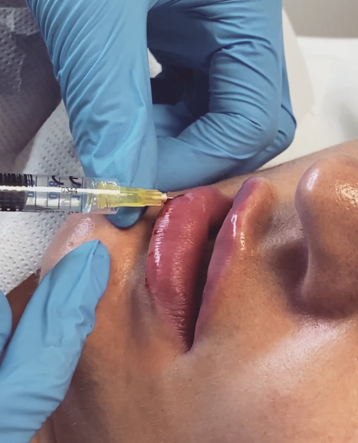 Modelowanie Ust i Twarzy